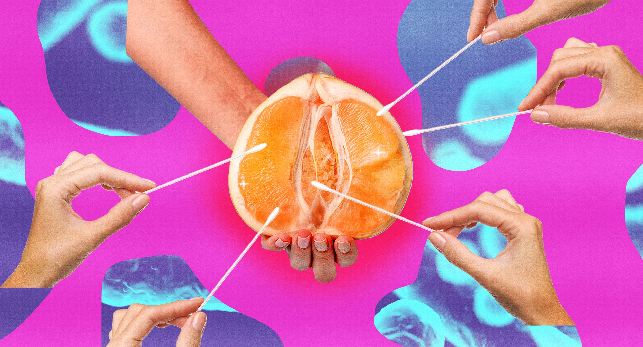 Vaginal Microbiome Testing: A Pattern of Self-Monitoring and Health Autonomy